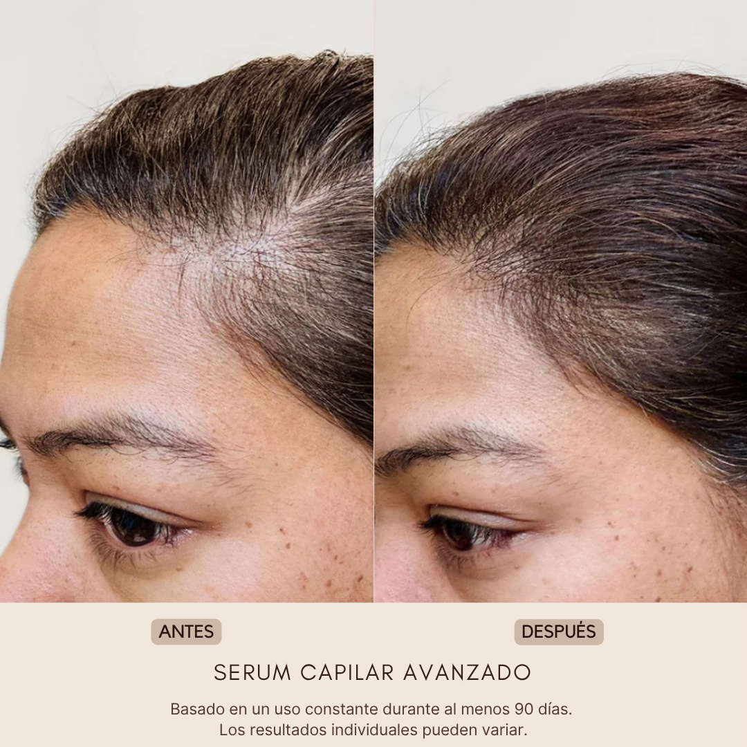 ELOREIA® Sérum Capilar Avanzado | Cabello Más Fuerte y con Mayor Densidad