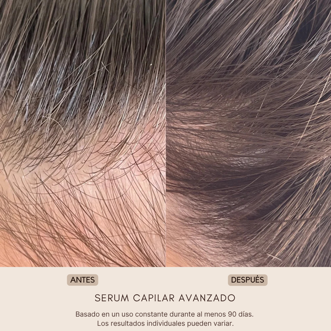 ELOREIA® Sérum Capilar Avanzado | Cabello Más Fuerte y con Mayor Densidad