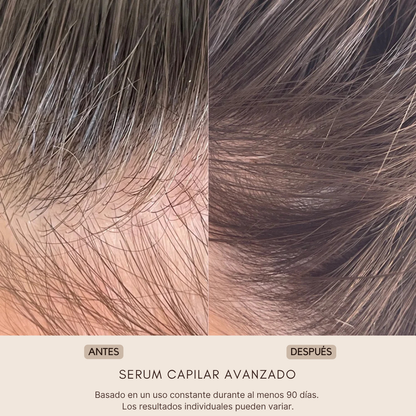 ELOREIA® Sérum Capilar Avanzado | Cabello Más Fuerte y con Mayor Densidad