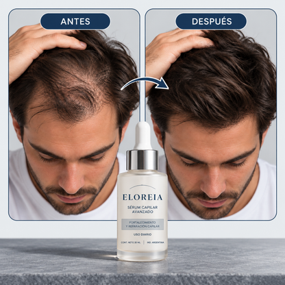 ELOREIA® Sérum Capilar Avanzado | Cabello Más Fuerte y con Mayor Densidad