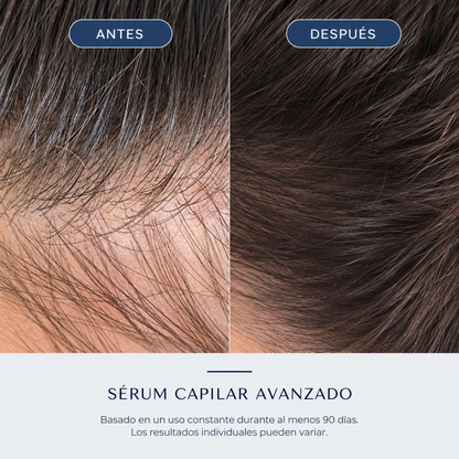 ELOREIA® Sérum Capilar Avanzado | Cabello Más Fuerte y con Mayor Densidad